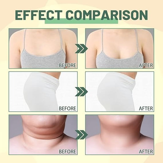 Collagen Lifting Body Oil, Beauty Women Tight Skin Trendy Zone